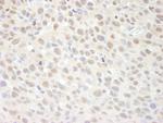 SUPT6H Polyclonal Antibody