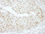 RBM16 Polyclonal Antibody