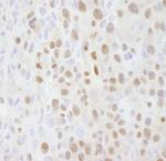 SMARCC2/BAF170 Antibody in Immunohistochemistry (Paraffin) (IHC (P))