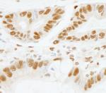 SF3b155/SAP155 Polyclonal Antibody