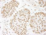 ACINUS/ACN1 Antibody in Immunohistochemistry (Paraffin) (IHC (P))