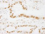 ACINUS/ACN1 Antibody in Immunohistochemistry (Paraffin) (IHC (P))