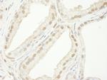 TRIM33/TIF1gamma Polyclonal Antibody