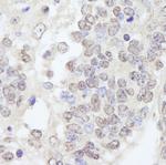 TRIM33/TIF1gamma Antibody in Immunohistochemistry (Paraffin) (IHC (P))