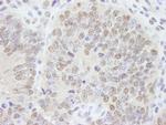 AKAP8/AKAP95 Antibody in Immunohistochemistry (Paraffin) (IHC (P))