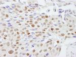 SAFB2 Antibody in Immunohistochemistry (Paraffin) (IHC (P))