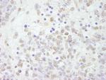 CSTF64 Antibody in Immunohistochemistry (Paraffin) (IHC (P))