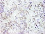 CSTF77 Antibody in Immunohistochemistry (Paraffin) (IHC (P))