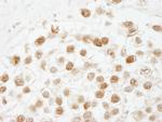CAF-1 p60 Antibody in Immunohistochemistry (Paraffin) (IHC (P))