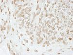 PC4 Antibody in Immunohistochemistry (Paraffin) (IHC (P))
