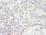 RBM25/RED120 Antibody in Immunohistochemistry (Paraffin) (IHC (P))