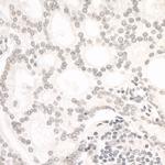 ARID1B Polyclonal Antibody