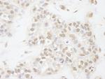 ATRX Antibody in Immunohistochemistry (Paraffin) (IHC (P))