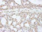 ATRX Polyclonal Antibody