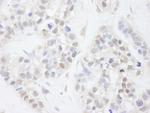MAGED2 Antibody in Immunohistochemistry (Paraffin) (IHC (P))