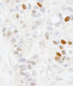 MAGED2 Polyclonal Antibody