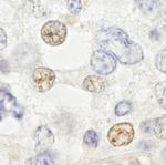 DDX46 Antibody in Immunohistochemistry (Paraffin) (IHC (P))