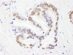 RBM26 Antibody in Immunohistochemistry (Paraffin) (IHC (P))