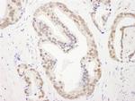 RBM26 Polyclonal Antibody