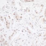 CHD8 Antibody in Immunohistochemistry (Paraffin) (IHC (P))