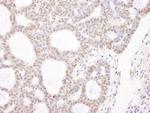 CHD3 Antibody in Immunohistochemistry (Paraffin) (IHC (P))