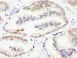 CHD3 Antibody in Immunohistochemistry (Paraffin) (IHC (P))