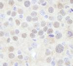 CHD3 Antibody in Immunohistochemistry (Paraffin) (IHC (P))