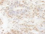 PolD3/p66 Antibody in Immunohistochemistry (Paraffin) (IHC (P))