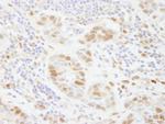 PolD3/p66 Antibody in Immunohistochemistry (Paraffin) (IHC (P))