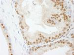 PolD3/p66 Polyclonal Antibody