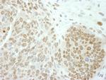 PolE3/p17 Antibody in Immunohistochemistry (Paraffin) (IHC (P))