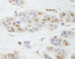 PALB2 Antibody in Immunohistochemistry (Paraffin) (IHC (P))