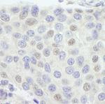 GTF3C1/TFIIIC220 Antibody in Immunohistochemistry (Paraffin) (IHC (P))