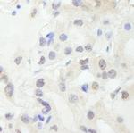 GTF3C1/TFIIIC220 Antibody in Immunohistochemistry (Paraffin) (IHC (P))