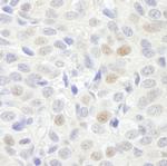 GTF3C3/TFIIIC102 Antibody in Immunohistochemistry (Paraffin) (IHC (P))