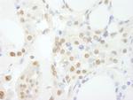GTF3C3/TFIIIC102 Polyclonal Antibody