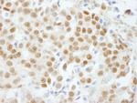 GTF3C5/TFIIIC63 Antibody in Immunohistochemistry (Paraffin) (IHC (P))
