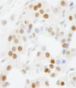 GTF3C5/TFIIIC63 Antibody in Immunohistochemistry (Paraffin) (IHC (P))