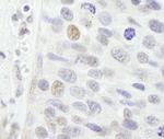 NBS1 Antibody in Immunohistochemistry (Paraffin) (IHC (P))