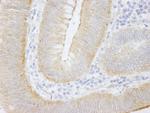 SPTAN1/Alpha II-spectrin Antibody in Immunohistochemistry (Paraffin) (IHC (P))