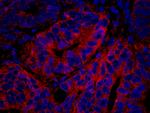 PTPN12 Antibody in Immunohistochemistry (Paraffin) (IHC (P))