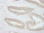 PTPN12 Antibody in Immunohistochemistry (Paraffin) (IHC (P))