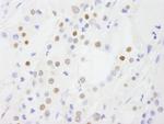 DDX54 Polyclonal Antibody