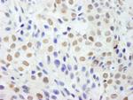DDX54 Antibody in Immunohistochemistry (Paraffin) (IHC (P))