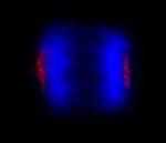 CEP170 Antibody in Immunocytochemistry (ICC/IF)