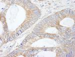 CIP2A Antibody in Immunohistochemistry (Paraffin) (IHC (P))