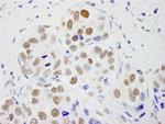 CPSF59 Antibody in Immunohistochemistry (Paraffin) (IHC (P))