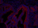 Coronin 2 Antibody in Immunohistochemistry (Paraffin) (IHC (P))
