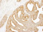 Coronin 2 Antibody in Immunohistochemistry (Paraffin) (IHC (P))