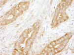 Coronin 2 Antibody in Immunohistochemistry (Paraffin) (IHC (P))